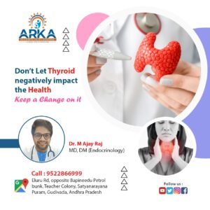 best thyroid specialist in gudivada